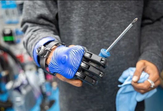 Revolutionary Breakthrough: English Man Receives 3D-Printed Bionic Fingers | Ghanaguardian.com Revolutionary Breakthrough: English Man Receives 3D-Printed Bionic Fingers