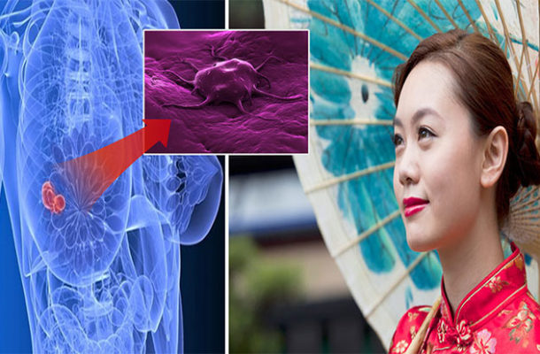 Cancer1 | Ghanaguardian.com