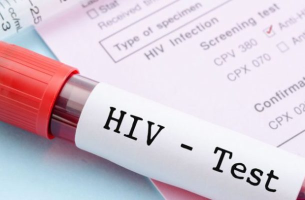 hiv-750x406 | Ghanaguardian.com