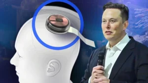 Elon Musk Reveals: Patient with Neuralink Chip Controls Computer Mouse Using Mind