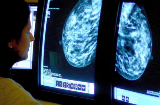 Screenshot_12-24-780x439 | Ghanaguardian.com Innovative AI Tool Predicts Breast Cancer Treatment Side Effects