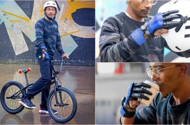 Revolutionary Breakthrough: English Man Receives 3D-Printed Bionic Fingers | Ghanaguardian.com Revolutionary Breakthrough: English Man Receives 3D-Printed Bionic Fingers