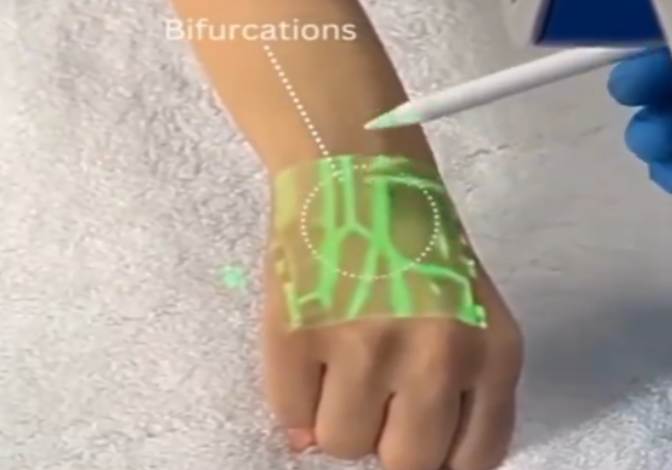 Revolutionary Vein-Finding Device: Illuminating Healthcare Innovation