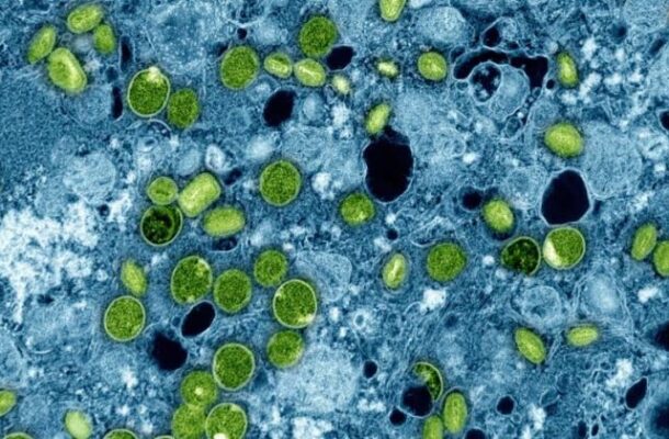 Scientists Create Groundbreaking Atlas of Human Body Cells | Ghanaguardian.com Scientists Create Groundbreaking Atlas of Human Body Cells
