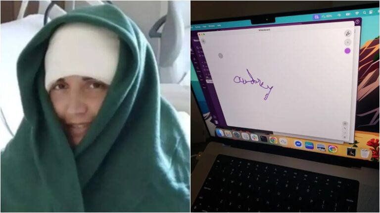 Paralyzed Woman Writes Name After 20 Years Using Elon Musk’s Neuralink Brain Chip