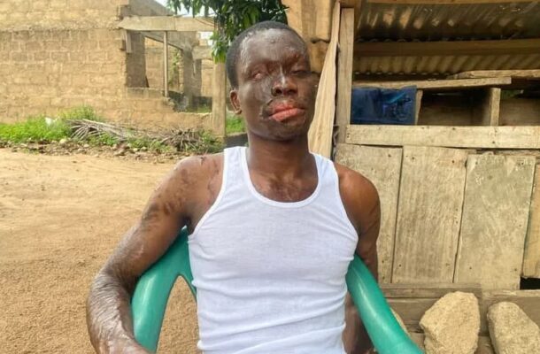 Derick Ofosu Gyan 1 | Ghanaguardian.com