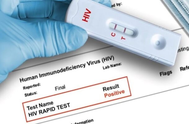 HIV KIT | Ghanaguardian.com