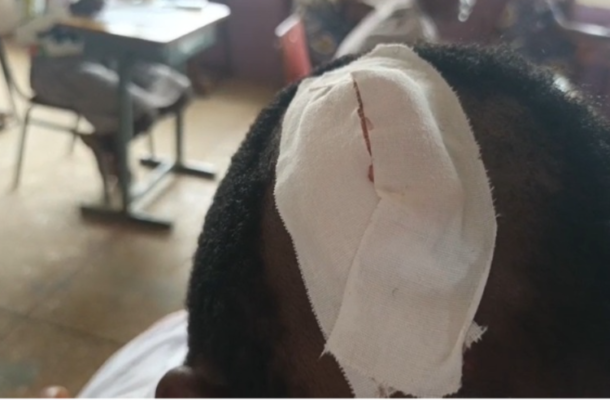 Person with a large white bandage wrapped over their ear and head, suggesting an injury or dressing in a clinical setting