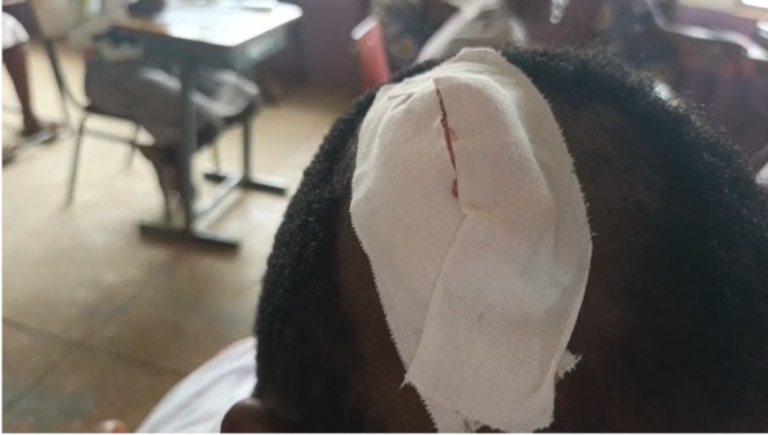Person with a large white bandage wrapped over their ear and head, suggesting an injury or dressing in a clinical setting