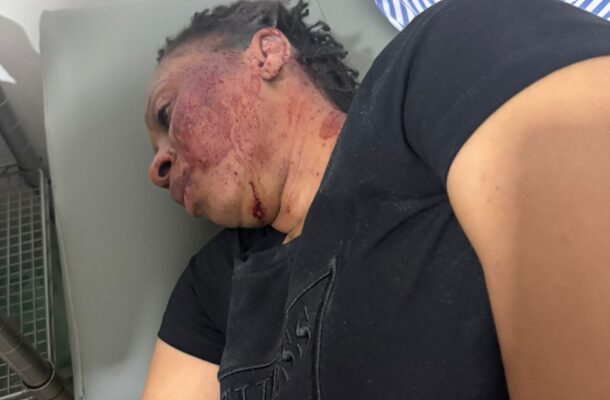 Person lying on a medical bed with a bruised, blood-streaked face and neck, wearing a black t-shirt, in a clinical room.