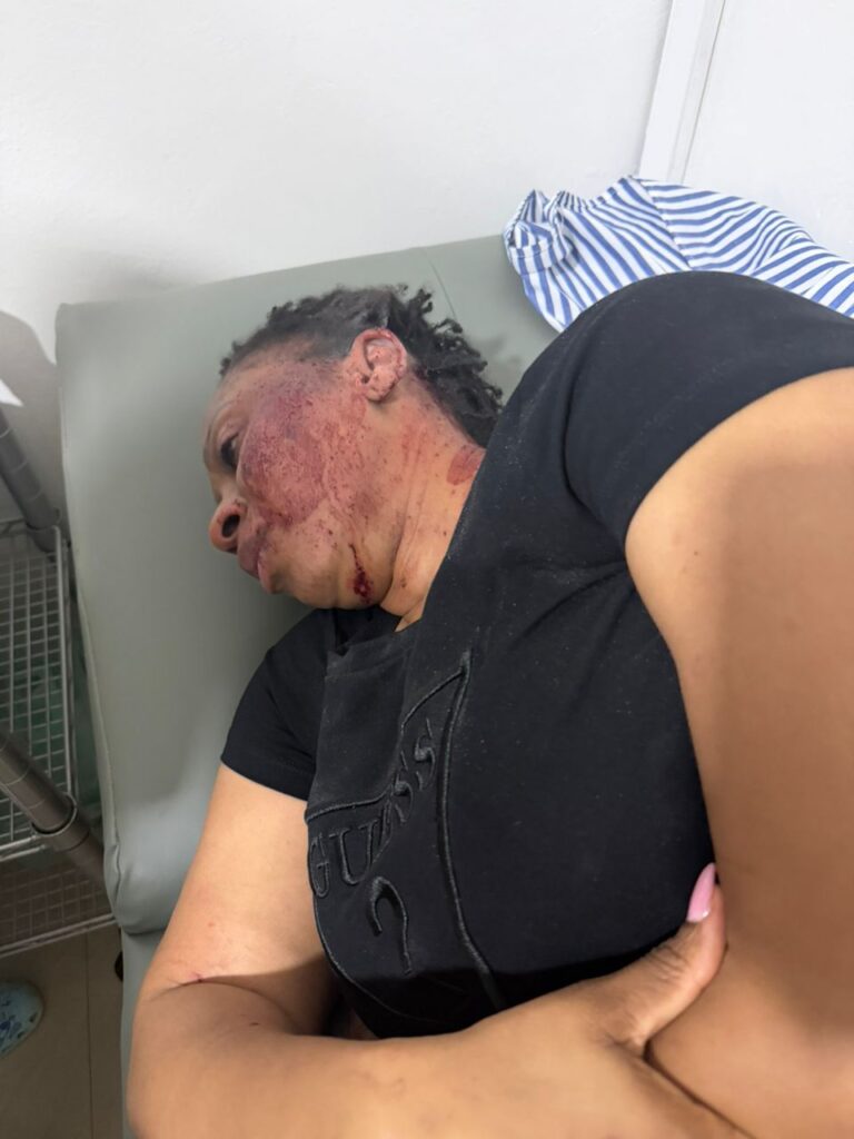 Person lying on a medical bed with a bruised, blood-streaked face and neck, wearing a black t-shirt, in a clinical room.