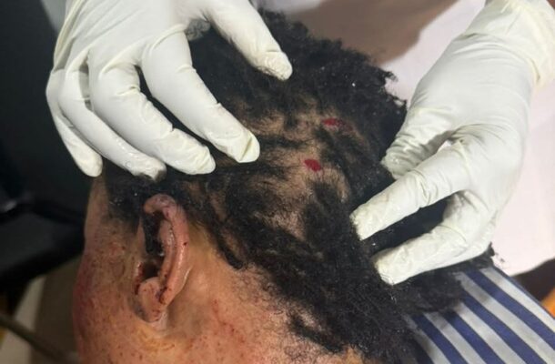 A healthcare worker with gloves inspects a dark-haired person's scalp, revealing small red wounds.