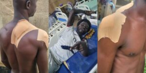 Triptych of an injured man with large bandages on his shoulders; first and third panels show bare, wrapped shoulders, center panel shows him in a hospital bed pointing at the camera.
