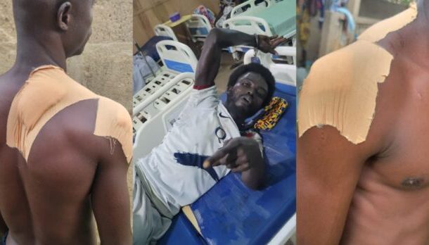assin-fosu-mason-696x348 | Ghanaguardian.com Triptych of an injured man with large bandages on his shoulders; first and third panels show bare, wrapped shoulders, center panel shows him in a hospital bed pointing at the camera.