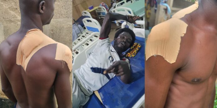 Triptych of an injured man with large bandages on his shoulders; first and third panels show bare, wrapped shoulders, center panel shows him in a hospital bed pointing at the camera.