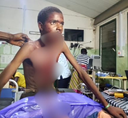 image-964 | Ghanaguardian.com Young man with severe injuries lying in a hospital bed, blurred wounds visible, as medical staff assist in a clinic.