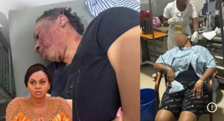 Collage showing a man with severe facial burns resting his head on a surface, with a small inset of a concerned woman in the corner, and a patient in a hospital gown seated as a nurse attends nearby.
