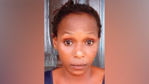 Close-up of a woman with short twists and a wide-eyed, surprised expression facing the camera.