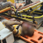 Injured person with head injury on an orange spine board, face blurred, surrounded by yellow ambulance gurney rails and responders in a medical setting.